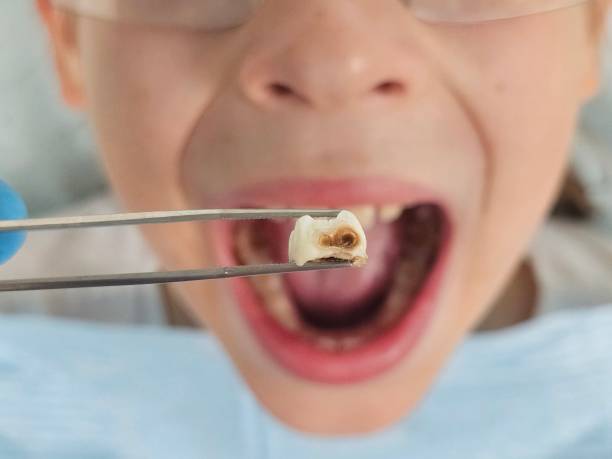 Best Emergency Denture Repair in Morgantown, IN