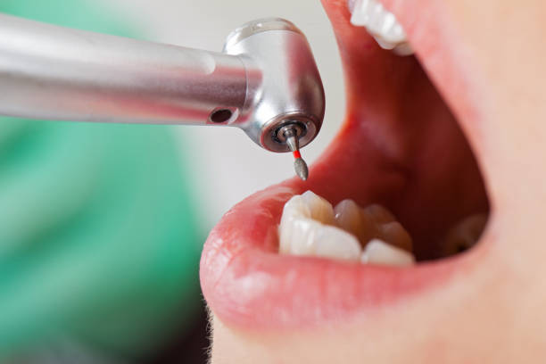Best Walk-In Emergency Dental Services in Morgantown, IN